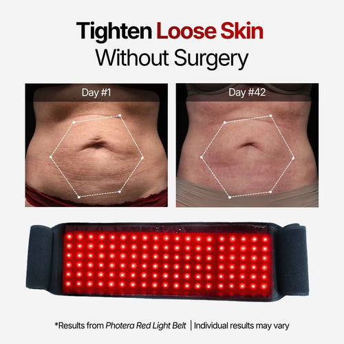 Photera Longevity - Red Light Therapy Belt